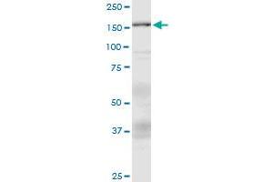 Western Blotting (WB) image for anti-Additional Sex Combs Like 1 (ASXL1) (AA 1-84) antibody (ABIN792966) (ASXL1 anticorps  (AA 1-84))