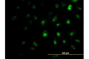 Immunofluorescence of monoclonal antibody to ZIC4 on HeLa cell. (ZIC4 anticorps  (AA 249-319))