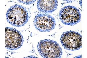 IHC analysis of DDX4 using anti-DDX4 antibody (ABIN7601203). (DDX4 anticorps  (AA 3-666))