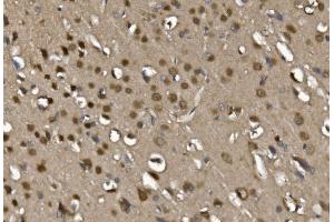 IHC analysis of MEF2C using anti-MEF2C antibody (ABIN6719606). (MEF2C anticorps)