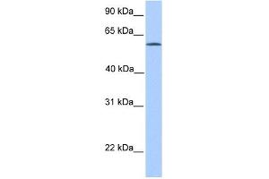 ACSBG2 antibody used at 1 ug/ml to detect target protein. (ACSBG2 anticorps  (Middle Region))