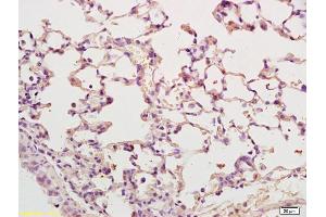 Formalin-fixed and paraffin embedded mouse lung labeled with Rabbit Anti-IL-2R gamma Polyclonal Antibody (ABIN1387540) at 1:200 followed by conjugation to the secondary antibody and DAB staining.