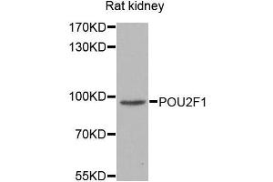 Western blot analysis of extracts of various cell lines, using POU2F1 antibody. (POU2F1 anticorps  (AA 15-290))
