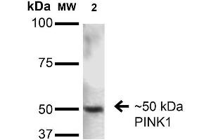 Western Blot analysis of Rat Brain showing detection of ~50 kDa PINK1 protein using Mouse Anti-PINK1 Monoclonal Antibody, Clone S4-15 . (PINK1 anticorps  (AA 112-496) (Biotin))