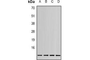 Western blot analysis of MIF expression in HEK293T (A), 22RV1 (B), Hela (C), HepG2 (D) whole cell lysates. (MIF anticorps)