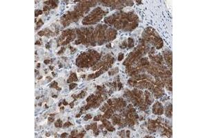 Immunohistochemical staining of human stomach with ADNP2 polyclonal antibody  shows strong cytoplasmic positivity in glandular cells at 1:20-1:50 dilution. (ADNP2 anticorps)