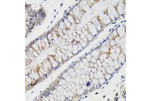 Immunohistochemistry of paraffin-embedded human rectum using CHMP4B antibody (ABIN5975521) at dilution of 1/100 (40x lens). (CHMP4B anticorps)
