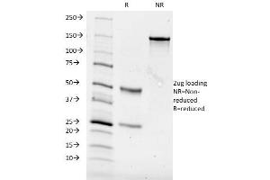 SDS-PAGE Analysis Purified CD84 Mouse Monoclonal Antibody (153-4D9). (CD84 anticorps)