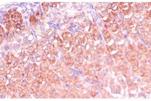 Immunohistochemistry of paraffin-embedded Mouse adrenal gland using CYP11B2 Polyclonal Antibody at dilution of 1:100 (40x lens).