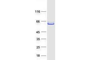 Validation with Western Blot