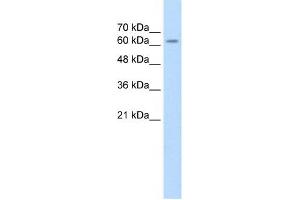 SARDH antibody used at 2. (SARDH anticorps  (Middle Region))