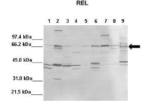 WB Suggested Anti-REL Antibody  Positive Control: Lane1: 100ug mouse liver, Lane2: 100ug mouse brain, Lane3: 100ug mouse heart, Lane4: 100ug mouse kidney, Lane5: 100ug mouse lung, Lane6: 100ug mouse thymus, Lane7: 100ug mouse spleen, Lane8: 100ug mouse testis, Lane9: 100ug mouse HeLa  Primary Antibody Dilution :  1:1000 Secondary Antibody :  Anti-rabbit-AP  Secondry Antibody Dilution :  1:10,000 Submitted by: Andreia Carvalho, Instituto de Biologia Molecular e Celular, Universidade do Porto (IBMC-UP) (c-Rel anticorps  (Middle Region))