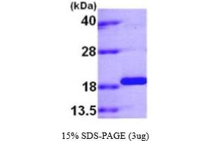 SDS-PAGE (SDS) image for Peptidylprolyl Isomerase (Cyclophilin)-Like 1 (PPIL1) (AA 1-166) (Active) protein (His tag) (ABIN666867)
