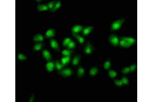 Immunofluorescence staining of ntera-2 cells with ABIN7172619 at 1:100, counter-stained with DAPI. (SOX21 anticorps  (AA 25-126))