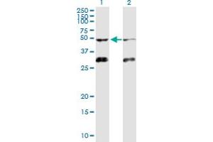 Western Blot analysis of ACVR1B expression in transfected 293T cell line by ACVR1B MaxPab polyclonal antibody.