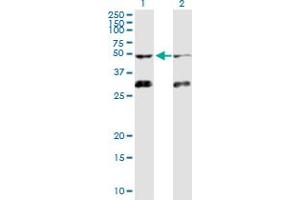 Western Blot analysis of ACVR1B expression in transfected 293T cell line by ACVR1B MaxPab polyclonal antibody. (Activin A Receptor Type IB/ALK-4 anticorps  (AA 1-505))