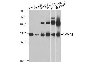 Western blot analysis of extracts of various cell lines, using YWHAE Antibody (ABIN5970417) at 1/1000 dilution. (YWHAE anticorps)