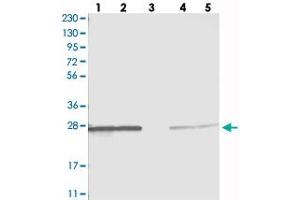Western blot analysis of Lane 1: RT-4, Lane 2: U-251 MG, Lane 3: Human Plasma, Lane 4: Liver, Lane 5: Tonsil with PMM1 polyclonal antibody . (PMM1 anticorps)