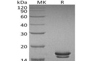 Western Blotting (WB) image for Interleukin 2 (IL2) protein (His tag) (ABIN7321270) (IL-2 Protein (His tag))