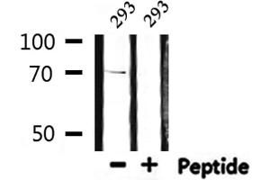 Western blot analysis of extracts from 293, using S6K Antibody. (RPS6KB1 anticorps  (C-Term))