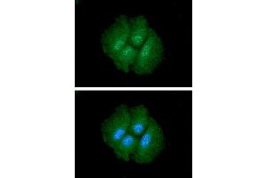 ICC/IF analysis of CTGF in Hep3B cells. (CTGF anticorps  (AA 27-349))