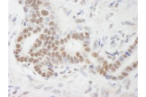 Immunohistochemistry (IHC) image for anti-ATP-Dependent RNA Helicase A (DHX9) (C-Term) antibody (ABIN7448530)