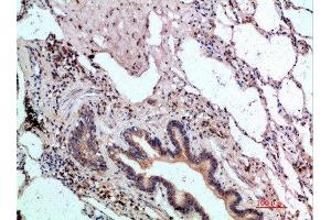 Immunohistochemical analysis of paraffin-embedded human-lung, antibody was diluted at 1:200 (ASCL1 anticorps  (AA 190-236))