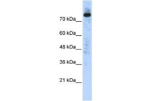 WB Suggested Anti-PLD2 Antibody Titration:  0. (Phospholipase D2 anticorps  (N-Term))