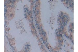 Detection of FBN1 in Human Prostate Tissue using Polyclonal Antibody to Fibrillin 1 (FBN1)