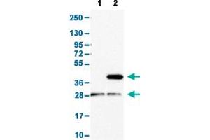 Western Blot analysis with CD1E polyclonal antibody . (CD1e anticorps  (AA 79-147))