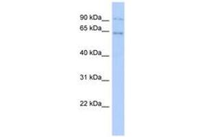 Image no. 1 for anti-Zinc Finger Protein 319 (ZNF319) (AA 35-84) antibody (ABIN6743566) (ZNF319 anticorps  (AA 35-84))