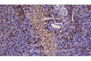 Detection of MGEA5 in Mouse Pancreas Tissue using Polyclonal Antibody to Meningioma Expressed Antigen 5 (MGEA5) (MGEA5 anticorps  (AA 319-450))