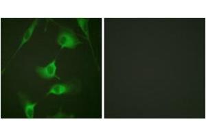 Immunofluorescence analysis of HeLa cells, using Keratin 8 (Ab-431) Antibody. (KRT8 anticorps  (AA 401-450))