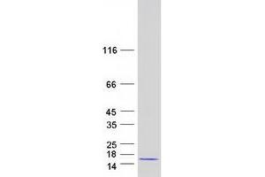 Validation with Western Blot
