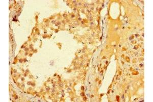 Immunohistochemistry of paraffin-embedded human testis tissue using ABIN7176667 at dilution of 1:100 (ELAC1 anticorps  (AA 1-363))