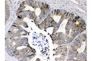 IHC analysis of RPS6 using anti- RPS6 antibody .