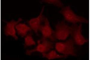 ABIN6269265 staining A2780 by IF/ICC.