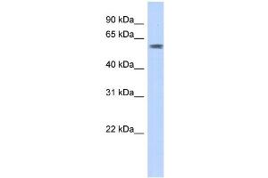 WB Suggested Anti-PGBD3 Antibody Titration:  0. (PGBD3 anticorps  (N-Term))
