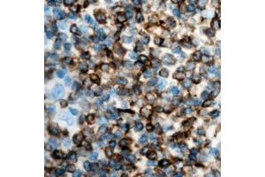 Immunohistochemical analysis of IFN gamma staining in human lymph node formalin fixed paraffin embedded tissue section. (Interferon gamma anticorps  (Center))