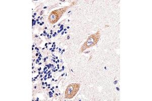 Immunohistochemical analysis of paraffin-embedded H.