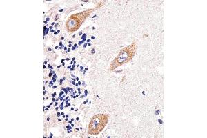 Immunohistochemical analysis of paraffin-embedded H. (PAPD4 anticorps  (N-Term))