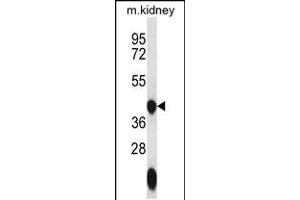 Western blot analysis in mouse kidney tissue lysates (35ug/lane). (GTPBP10 anticorps  (C-Term))