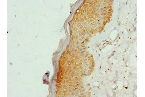 Immunohistochemistry of paraffin-embedded human skin tissue using ABIN7148255 at dilution of 1:100