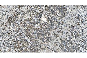 IHC analysis of NOX2/gp91phox/CYBB using anti-NOX2/gp91phox/CYBB antibody (ABIN7599875). (CYBB anticorps  (AA 124-559))