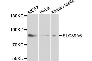 Western blot analysis of extracts of various cell lines, using SLC39A6 antibody. (SLC39A6 anticorps)