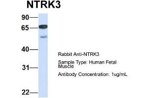 Host:  Rabbit  Target Name:  NTRK3  Sample Type:  Human Fetal Muscle  Antibody Dilution:  1. (NTRK3 anticorps  (C-Term))