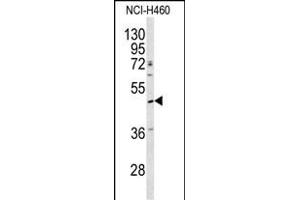 Western blot analysis of SERPINA4 antibody (C-term) (ABIN391661 and ABIN2841572) in NCI- cell line lysates (35 μg/lane). (SERPINA4 anticorps  (C-Term))
