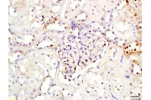 Formalin-fixed and paraffin embedded rat kidney labeled with Rabbit Anti-NFKBIA/IKB alpha Polyclonal Antibody, Unconjugated (ABIN674454) at 1:200 followed by conjugation to the secondary antibody and DAB staining