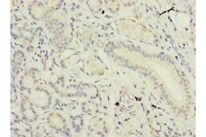 Immunohistochemistry of paraffin-embedded human pancreatic tissue using ABIN7171032 at dilution of 1:100 (SUSD4 anticorps  (AA 56-290))