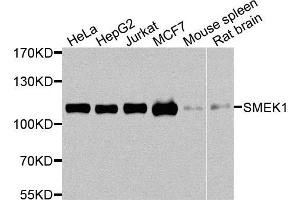 Western blot analysis of extracts of various cells, using SMEK1 antibody. (SMEK1 anticorps)